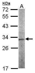 Anti-CHMP5 Antibody