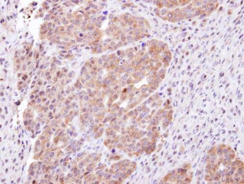Anti-CHMP5 Antibody