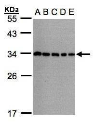 Anti-CHMP5 Antibody