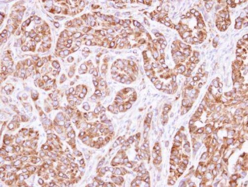 Anti-ACTL8 Antibody