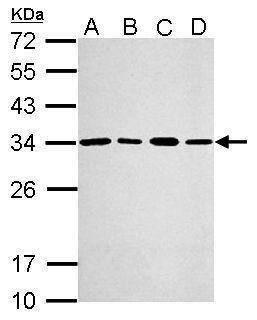 Anti-PSME3 Antibody