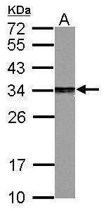Anti-PSME3 Antibody