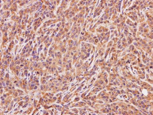 Anti-ACMSD Antibody