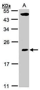 Anti-TPRKB Antibody