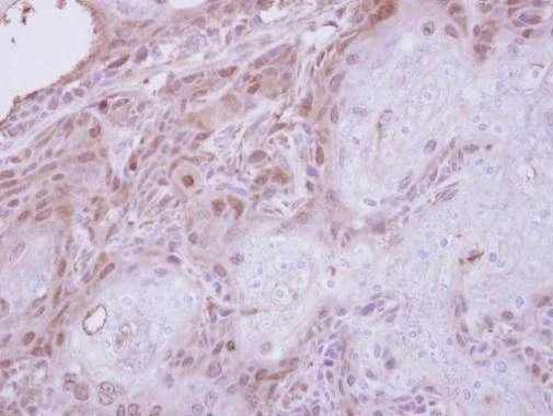 Anti-TPRKB Antibody