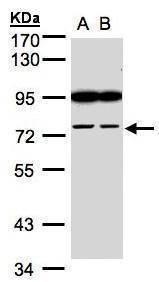 Anti-FSD2 (N-term) Antibody