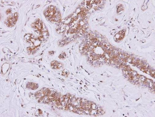 Anti-FSD2 (N-term) Antibody