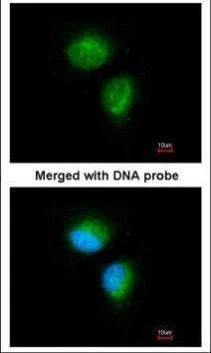 Anti-MMACHC Antibody