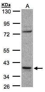 Anti-CCDC68 Antibody