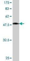 Anti-VBP1 Antibody