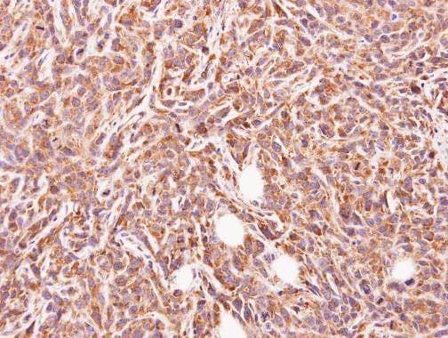 Anti-GLYATL1 Antibody