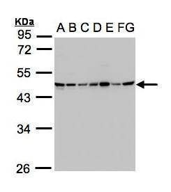 Anti-SUCLG2 Antibody