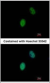 Anti-FHL5 Antibody