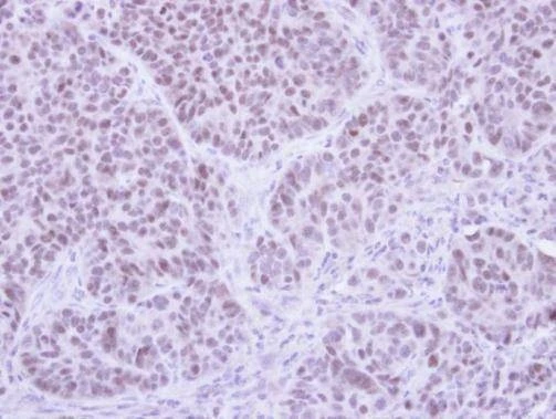 Anti-FHL5 Antibody