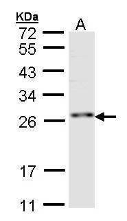 Anti-ZNF313 Antibody