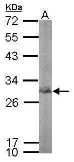 Anti-BPGM Antibody