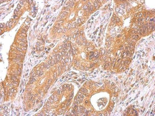 Anti-C6orf97 Antibody