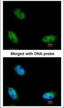 Anti-NSUN6 Antibody