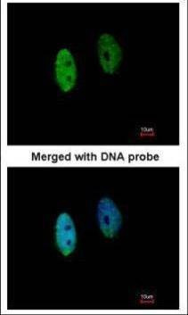 Anti-DENND1B Antibody