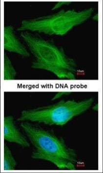 Anti-beta Tubulin Antibody