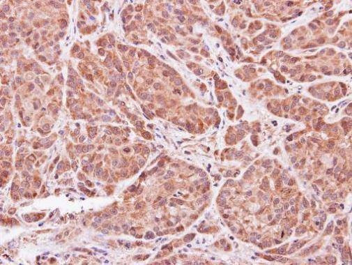 Anti-ASB9 Antibody