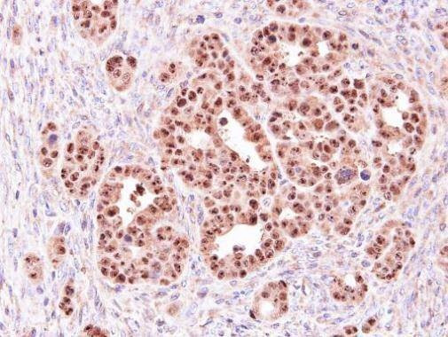 Anti-ALOXE3 Antibody