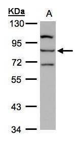 Anti-ALOXE3 Antibody