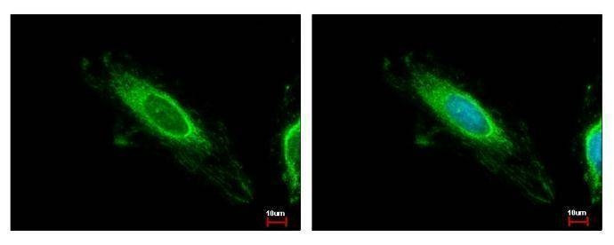 Anti-TBRG4 Antibody