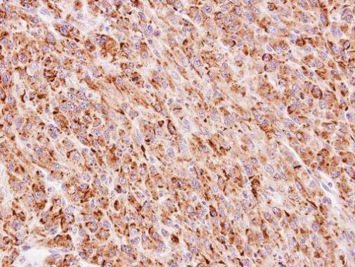 Anti-TTC30A Antibody