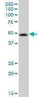 Anti-VIPR2 Antibody