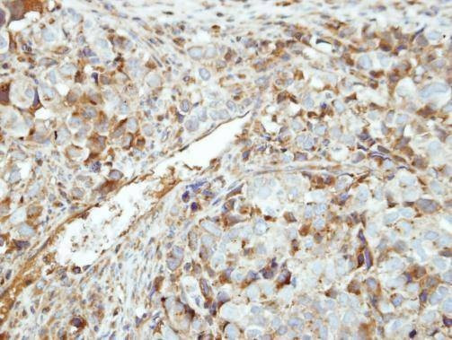 Anti-GK5 Antibody