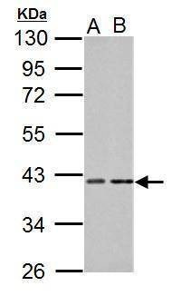 Anti-PKA C alpha Antibody