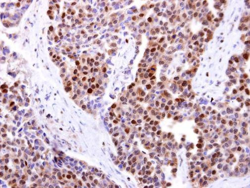Anti-DCK Antibody