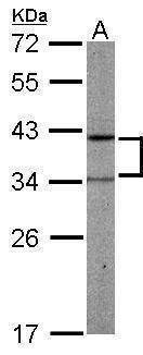 Anti-PRPSAP2 Antibody