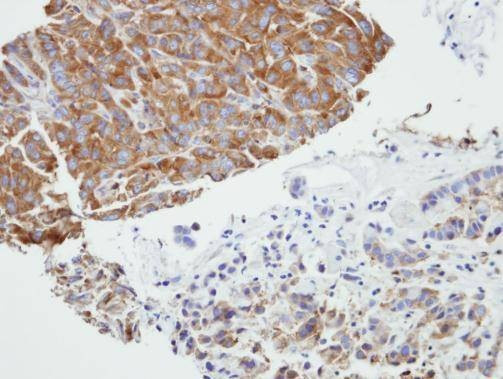 Anti-PRPSAP2 Antibody