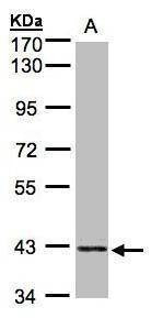 Anti-PRPSAP2 Antibody