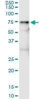 Anti-VNN1 Antibody