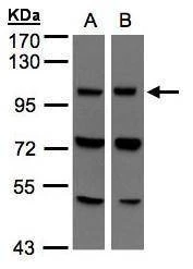Anti-VPS11 Antibody