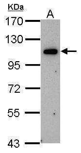Anti-OSBPL6 (C-term) Antibody