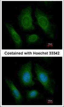 Anti-OSBPL6 (C-term) Antibody