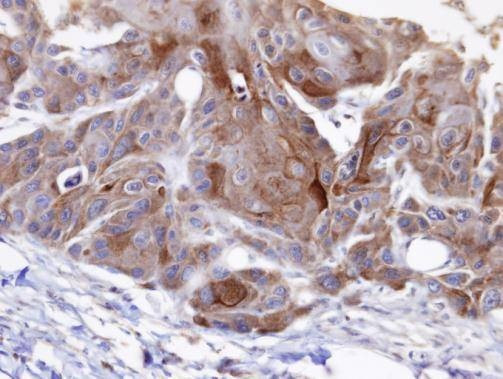 Anti-OSBPL6 (C-term) Antibody