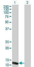 Anti-VPREB3 Antibody