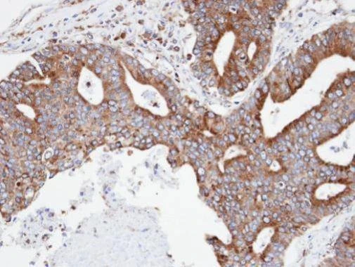 Anti-Copine 3 Antibody
