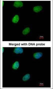 Anti-ITPK1 Antibody