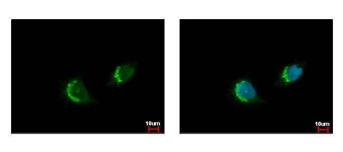 Anti-ETEA (C-term) Antibody