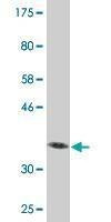 Anti-VPS16 Antibody