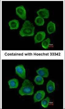 Anti-PTGFRN (C-term) Antibody