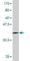Anti-VPS18 Antibody