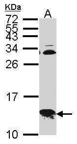Anti-COX6B1 Antibody