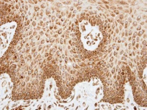 Anti-COX6A2 Antibody